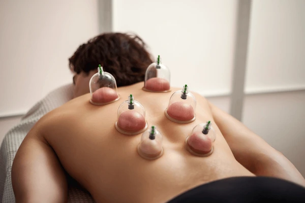Body Cupping Therapy